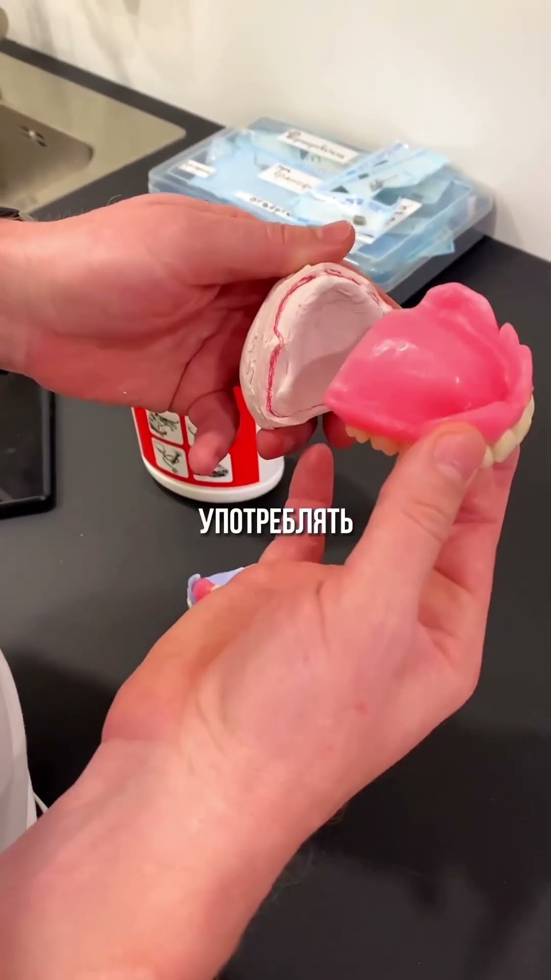 превью для видео: Как жить с протезами?