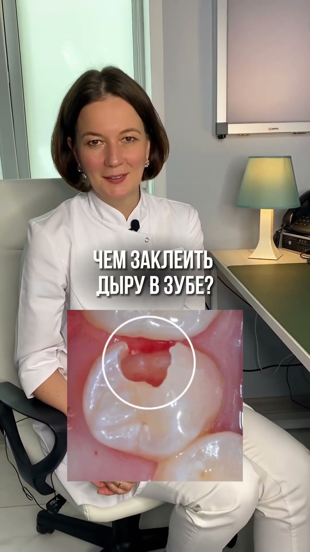 превью для видео: Чем заклеить дыру в зубе?