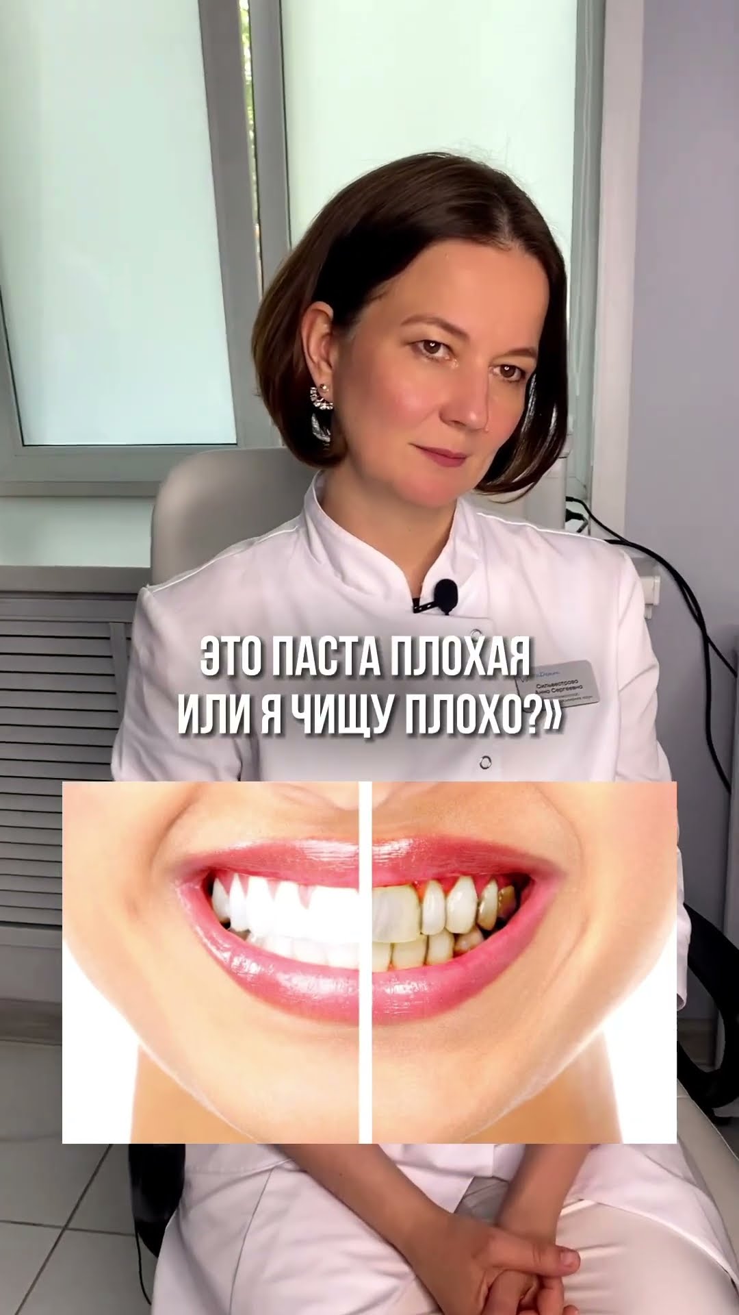превью для видео: Что делать если чувствуешь налет на зубах?