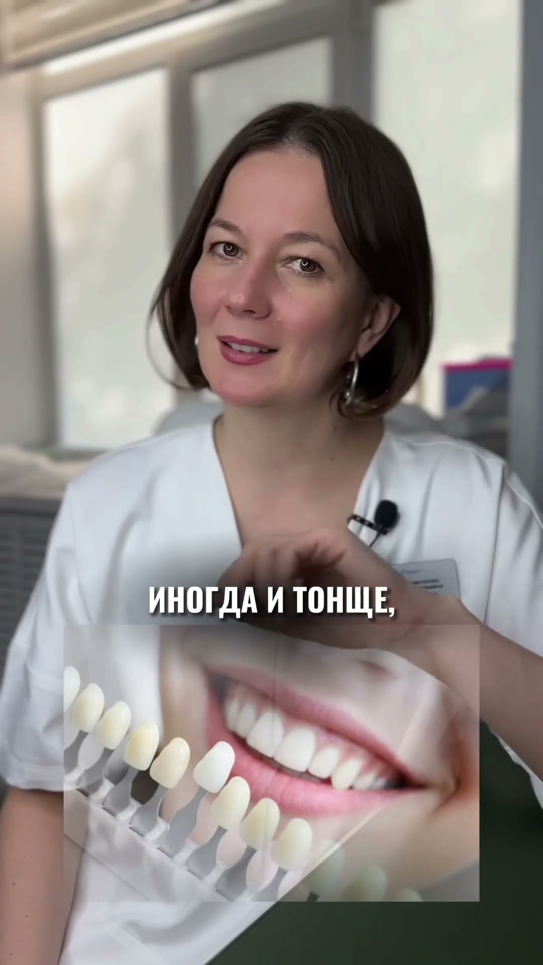 превью для видео: Виниры — прочные или нет?