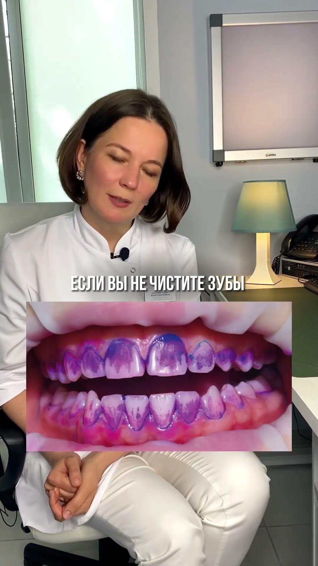 превью для видео: Что будет если не чистить язык?