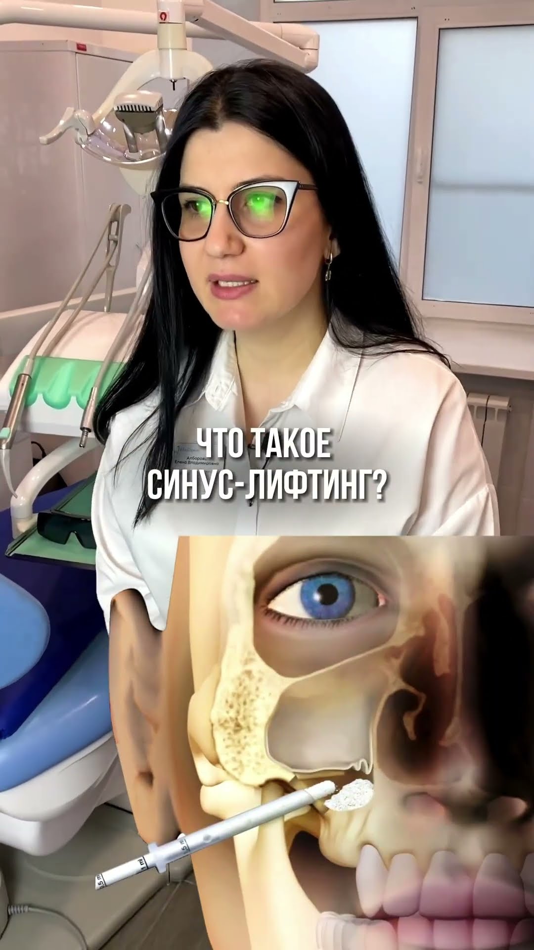 превью для видео: Что такое синус-лифтинг?