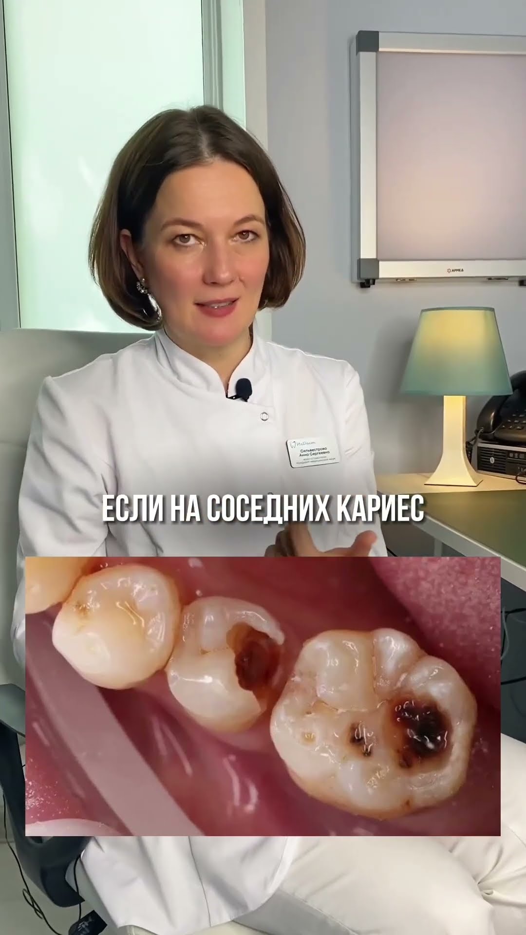 превью для видео: Причина дыр между зубами!