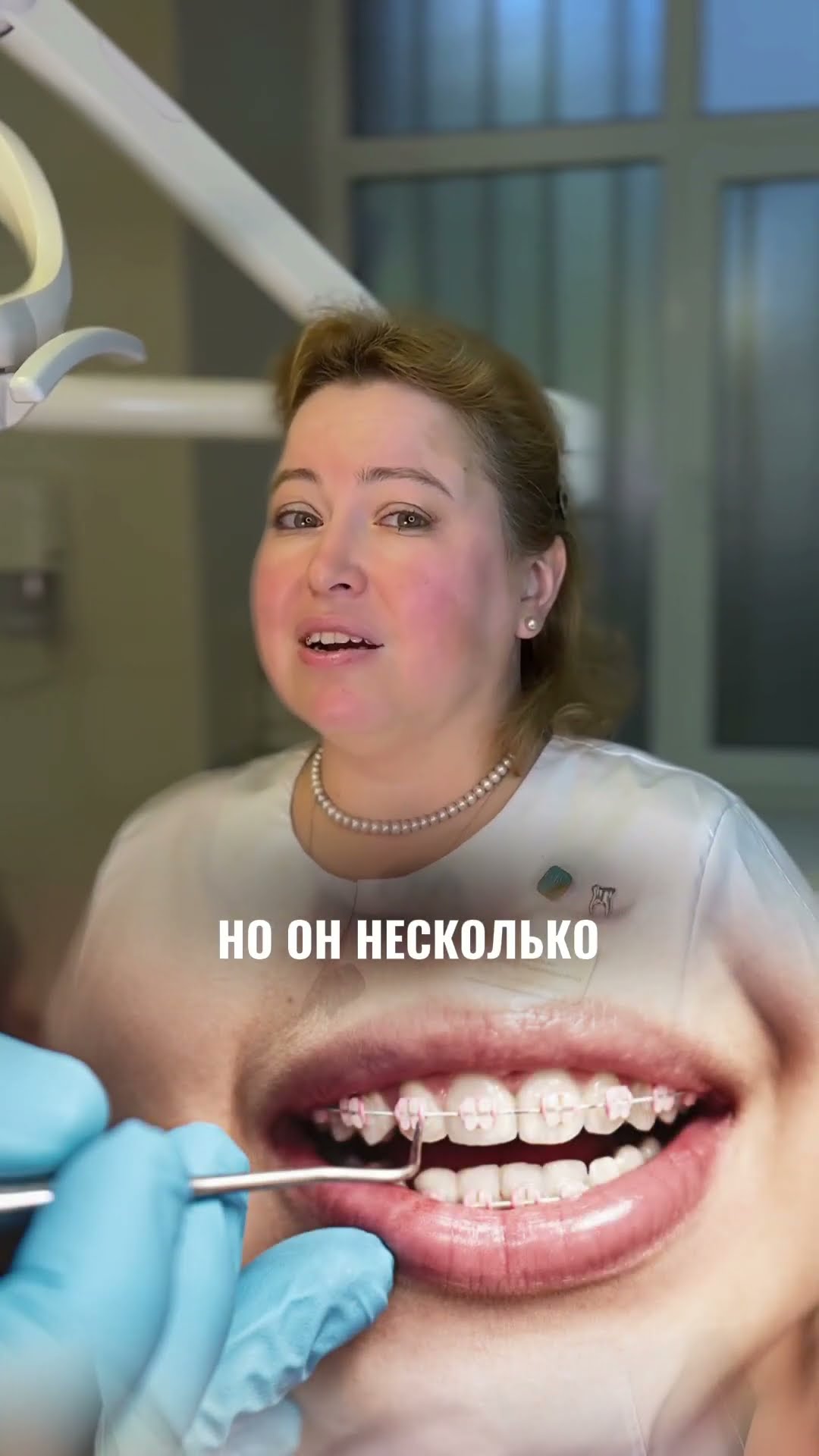 превью для видео: Какие бывают виды брекетов?